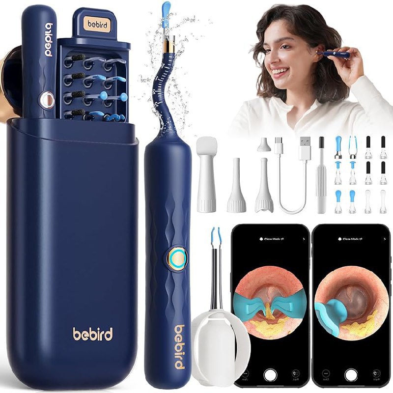 Bebird Otoskop: Bis zu 20% Rabatt Deal